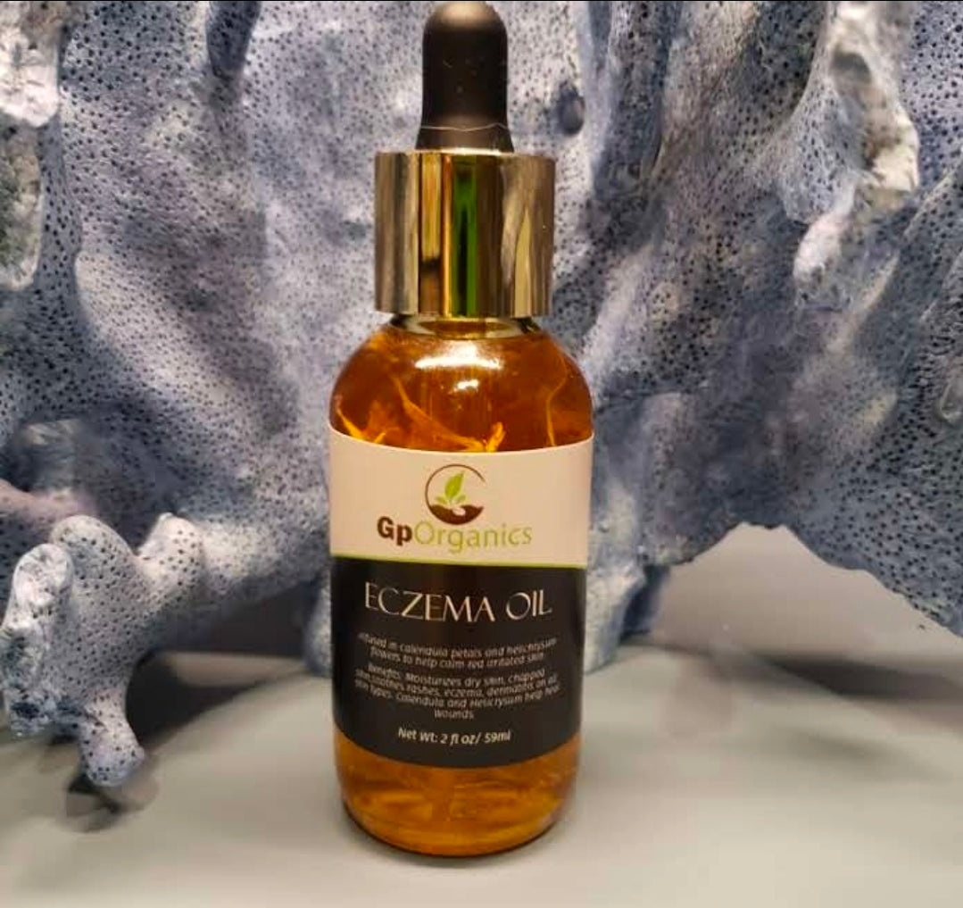 Eczema Relief Oil